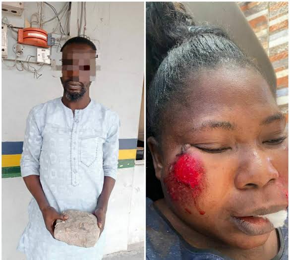 Police confirms arrest of man who brutalised his ex-wife for putting marks on their children