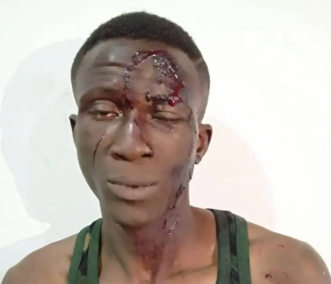 Police arrest notorious armed robber for stabbing victim over iPhone in Abuja